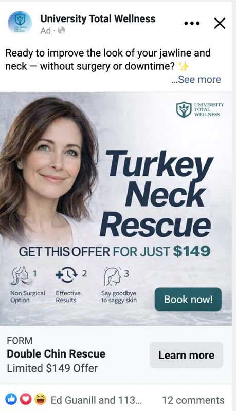 University Total Wellness Facebook ad: Turkey Neck Rescue, second creative