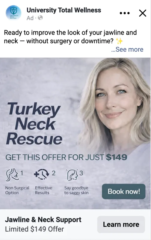 University Total Wellness Facebook ad: Turkey Neck Rescue, $149 offer